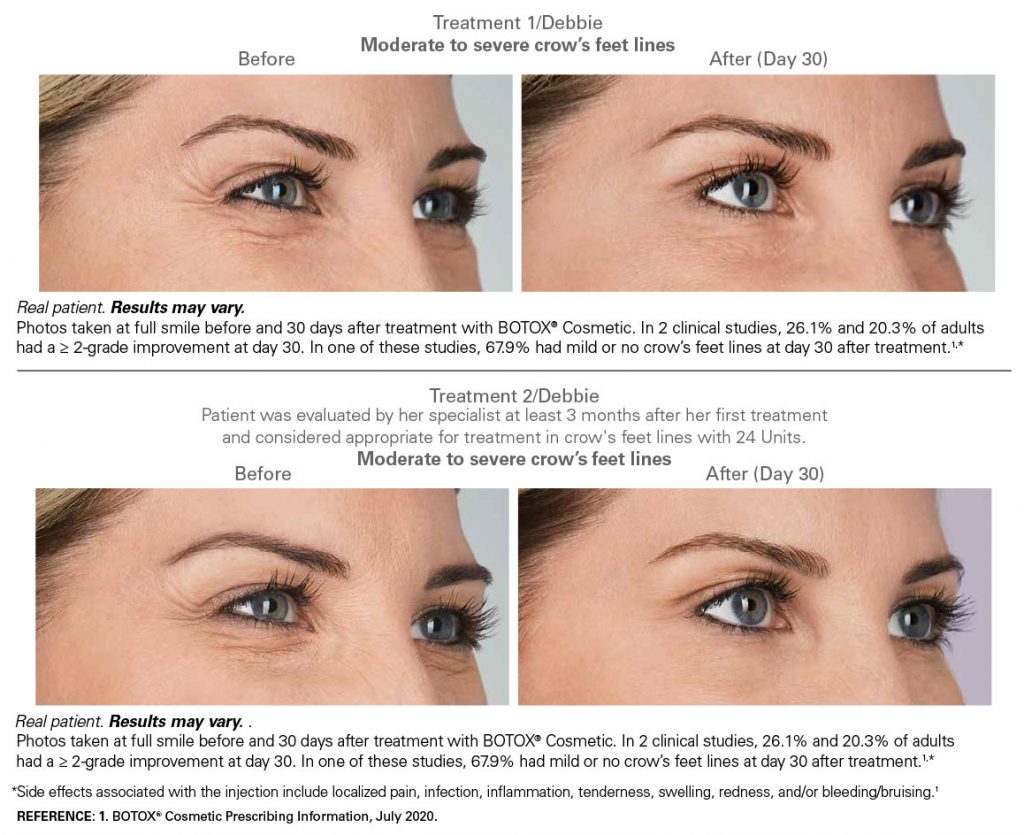INJECTABLES - The Perfect Image MedSpa